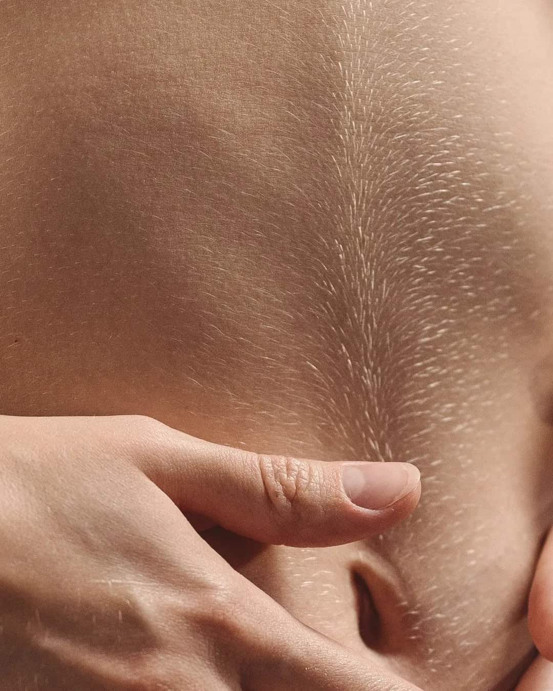 Close view of crinkled skin on the stomach