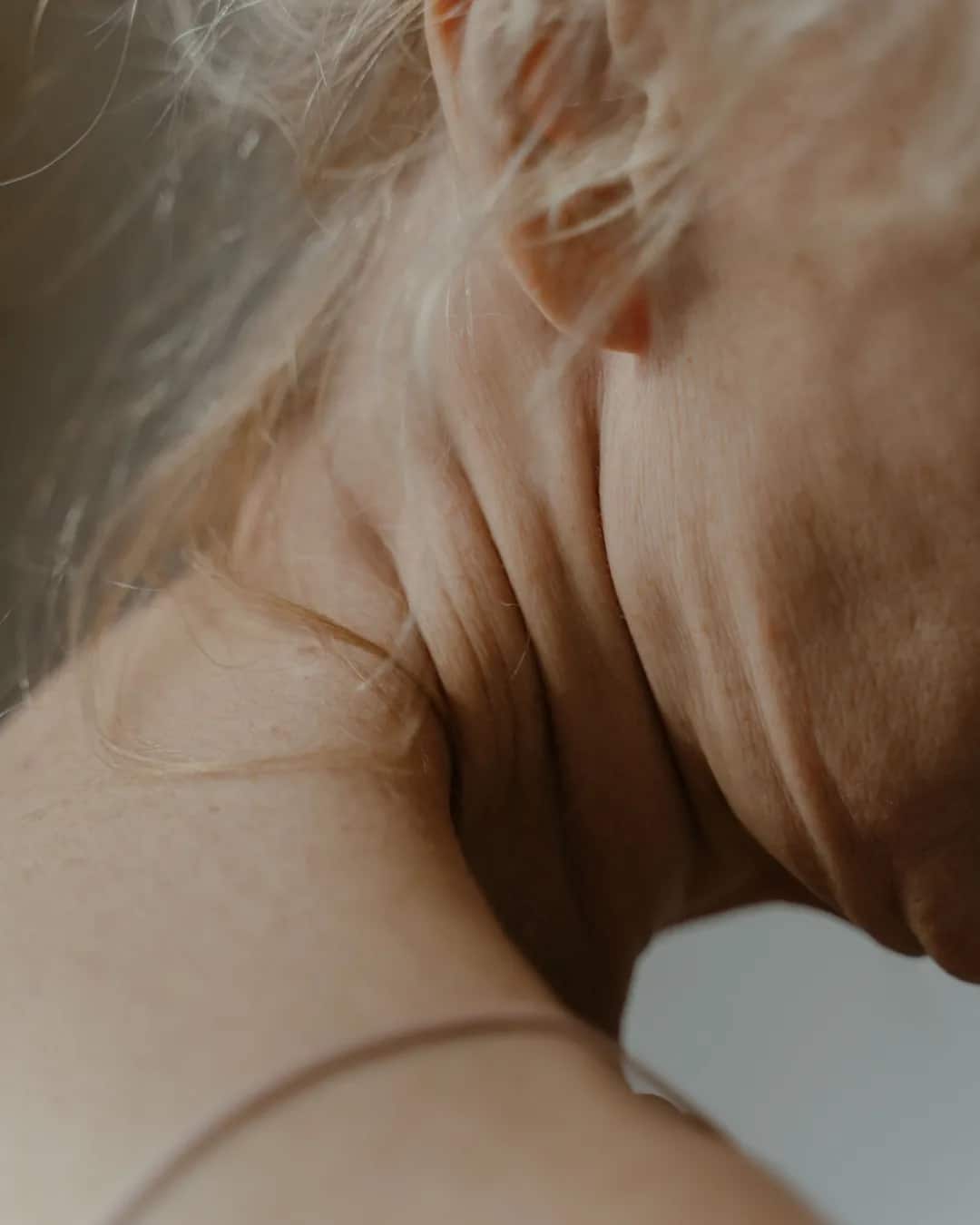 Side of a woman's neck with horizontal folds, face out of frame